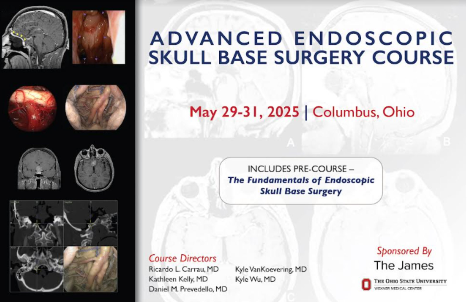 Advanced Endoscopic Skull Base Surgery Course